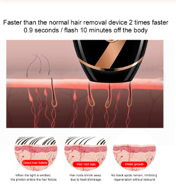 Epilateur de beauté laser